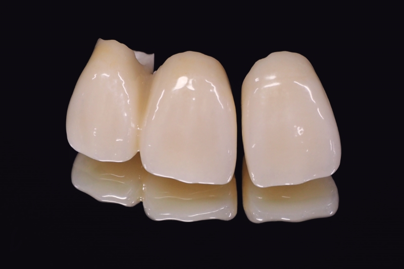 「強い」「軽い」「優しい」ジルコニア