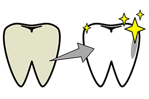 白くなるメカニズム①